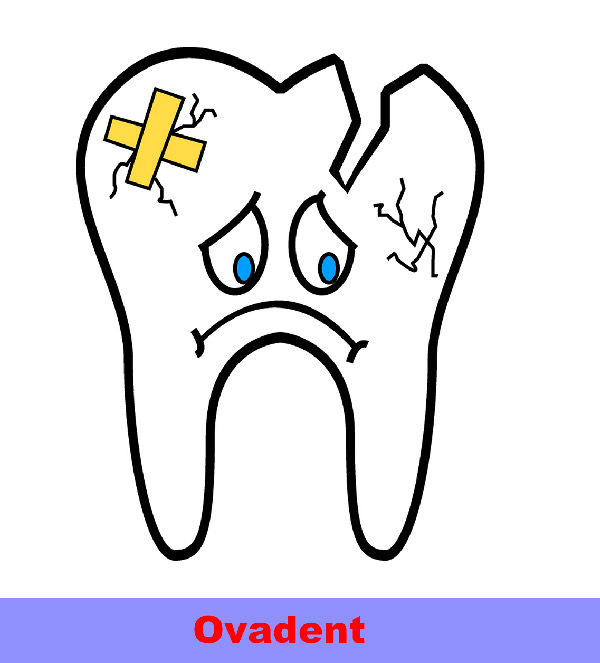 Bonding Diş Nedir  Ve Nasıl Uygulanır ? 